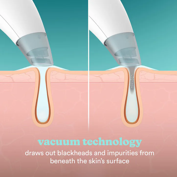 HoMedics Refresh Hydradermabrasion, additional product view 3