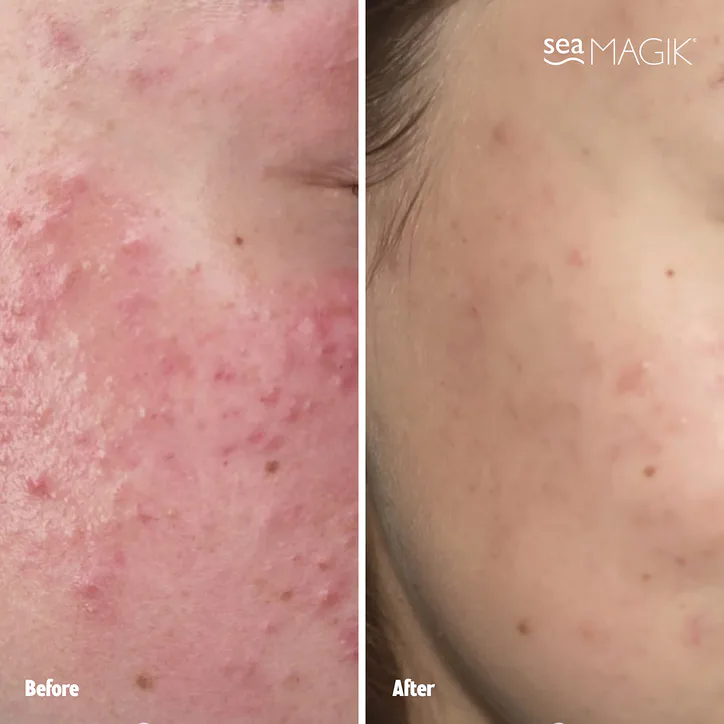 Sea Magik Mild Exfoliant detail 3