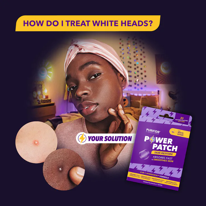 Purifide by Acnecide Power Pimple Patch, Skin Restore for Whiteheads, 23 Patches, additional product view 3
