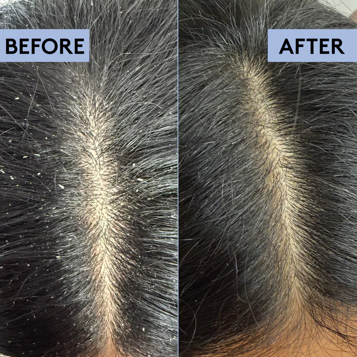Delhicious Scalp-Eaze Exfoliate & Clarify Scalp Scrub detail 3